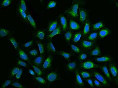 Immunocytochemistry/ Immunofluorescence: ELOVL5 Antibody [NBP2-97520]