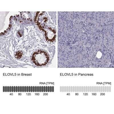 Immunohistochemistry-Paraffin: ELOVL5 Antibody [NBP2-33500]