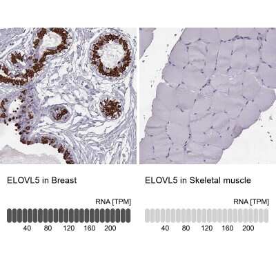 Immunohistochemistry-Paraffin: ELOVL5 Antibody [NBP2-33500]