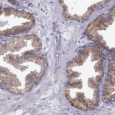 Immunohistochemistry-Paraffin: ELOVL5 Antibody [NBP2-33500]