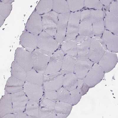 Immunohistochemistry-Paraffin: ELOVL5 Antibody [NBP2-33500]