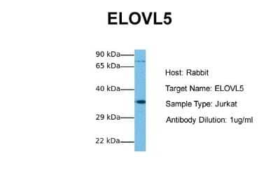 Western Blot: ELOVL5 Antibody [NBP1-59539]