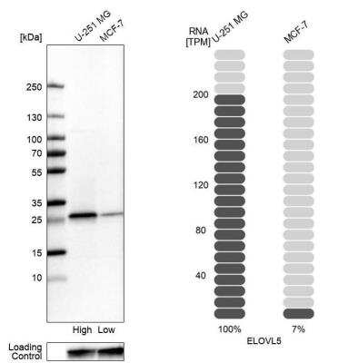 Western Blot: ELOVL5 Antibody [NBP2-33500]