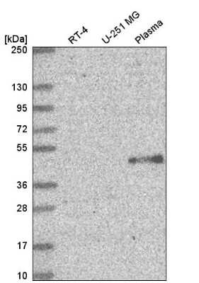 Western Blot: ELOVL5 Antibody [NBP2-58784]