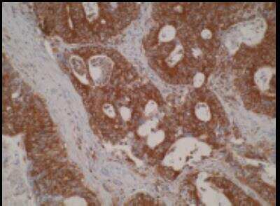 Immunohistochemistry: ELOVL5 Antibody (Z88) - BSA Free [NBP2-54809]