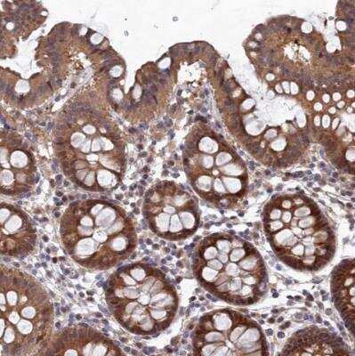 Immunohistochemistry-Paraffin: ELOVL6 Antibody [NBP1-82082]