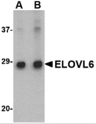 Western Blot: ELOVL6 AntibodyBSA Free [NBP2-81714]