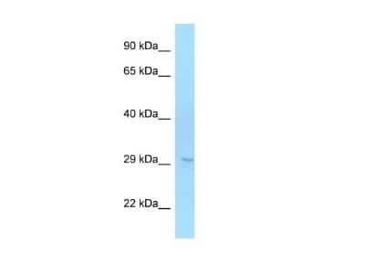 Western Blot: ELOVL6 Antibody [NBP2-82998]