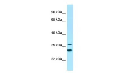 Western Blot: ELOVL6 Antibody [NBP2-82999]