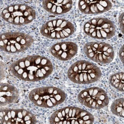 Immunohistochemistry-Paraffin: ELOVL7 Antibody [NBP1-93926]