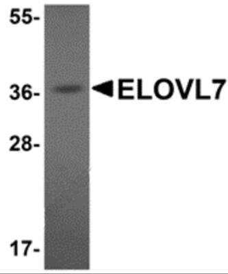 Western Blot: ELOVL7 AntibodyBSA Free [NBP2-82088]