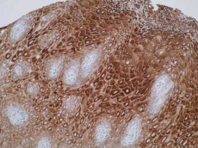 Immunohistochemistry: ELOVL7 Antibody (Z26) - BSA Free [NBP2-50384]
