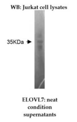 Western Blot: ELOVL7 Antibody (Z26)BSA Free [NBP2-50384]