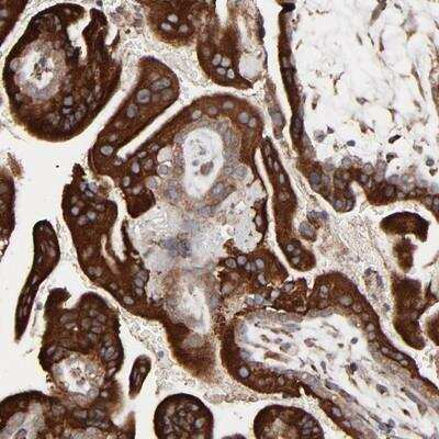 Immunohistochemistry-Paraffin: ELP2 Antibody [NBP1-83819]