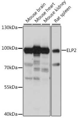 Western Blot: ELP2 AntibodyAzide and BSA Free [NBP3-04937]