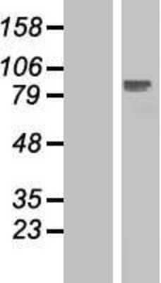 Western Blot: ELP2 Overexpression Lysate [NBP2-06839]