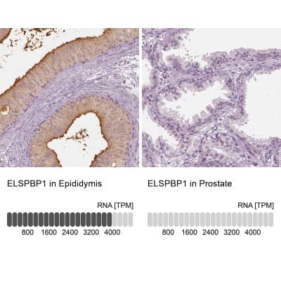 Immunohistochemistry-Paraffin: ELSPBP1 Antibody [NBP2-13957]