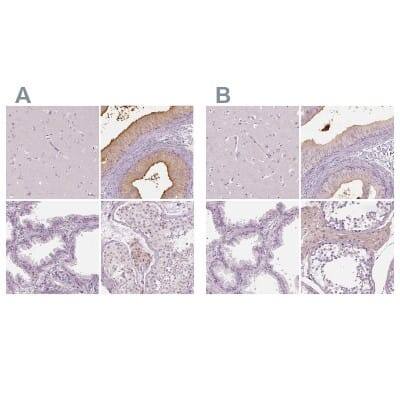 Immunohistochemistry-Paraffin: ELSPBP1 Antibody [NBP2-13957]