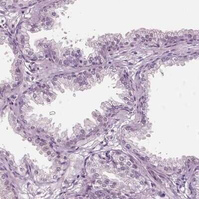 Immunohistochemistry-Paraffin: ELSPBP1 Antibody [NBP2-13957]