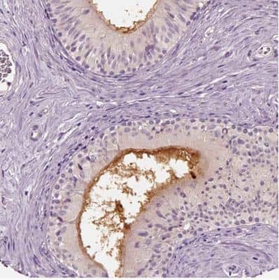 Immunohistochemistry-Paraffin: ELSPBP1 Antibody [NBP2-13958]