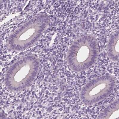 Immunohistochemistry-Paraffin: ELSPBP1 Antibody [NBP2-13958]