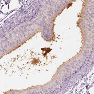 Immunohistochemistry-Paraffin: ELSPBP1 Antibody [NBP2-13958]