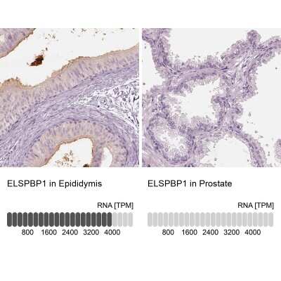 Immunohistochemistry-Paraffin: ELSPBP1 Antibody [NBP2-13958]