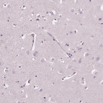 Immunohistochemistry-Paraffin: ELSPBP1 Antibody [NBP2-13958]
