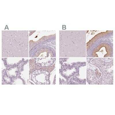 Immunohistochemistry-Paraffin: ELSPBP1 Antibody [NBP2-13958]