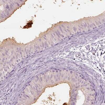 Immunohistochemistry-Paraffin: ELSPBP1 Antibody [NBP2-13958]