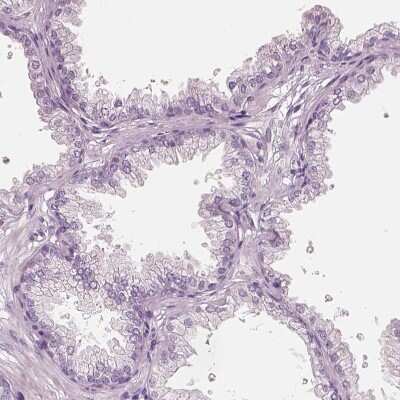 Immunohistochemistry-Paraffin: ELSPBP1 Antibody [NBP2-13958]