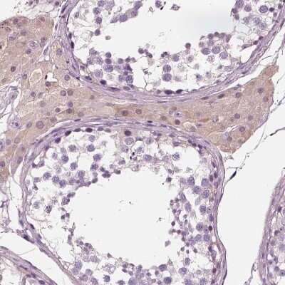 Immunohistochemistry-Paraffin: ELSPBP1 Antibody [NBP2-13958]