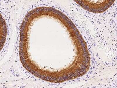 Immunohistochemistry-Paraffin: ELSPBP1 Antibody [NBP2-97840]