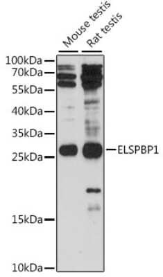 Western Blot: ELSPBP1 AntibodyAzide and BSA Free [NBP3-04400]