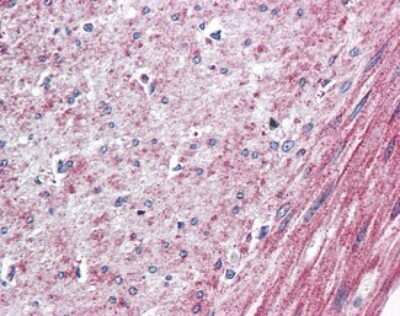 Immunohistochemistry-Paraffin: ELTD1/ETL Antibody - BSA Free [NBP2-29387]