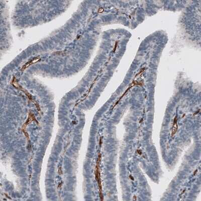Immunohistochemistry-Paraffin: ELTD1/ETL Antibody (CL4164) [NBP2-59041]