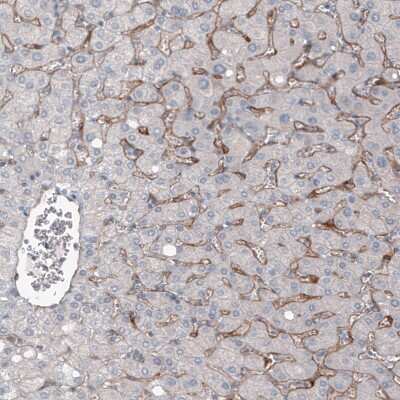 Immunohistochemistry-Paraffin: ELTD1/ETL Antibody (CL4164) [NBP2-59041]