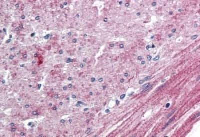 Immunohistochemistry-Paraffin: ELTD1/ETL Antibody [NBP3-14306]