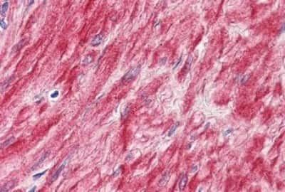 Immunohistochemistry-Paraffin: ELTD1/ETL Antibody [NBP3-14306]