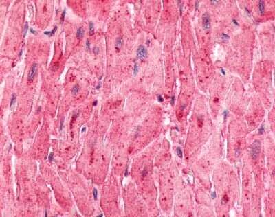 Immunohistochemistry-Paraffin: ELTD1/ETL Antibody - BSA Free [NLS2113]
