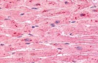 Immunohistochemistry-Paraffin: ELTD1/ETL Antibody - BSA Free [NLS2113]
