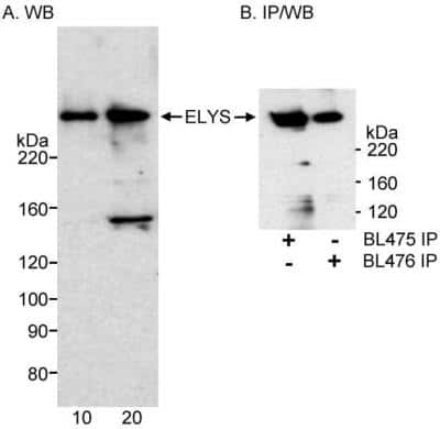 Immunoprecipitation: ELYS Antibody [NB600-238]