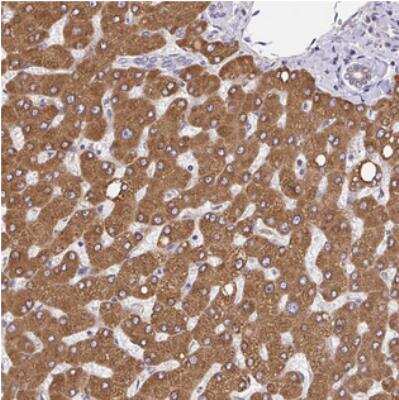 Immunohistochemistry: EMAP-5 Antibody [NBP2-30573]