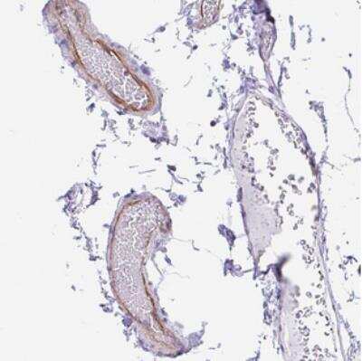 Immunohistochemistry-Paraffin: EMAP-5 Antibody [NBP2-30628]