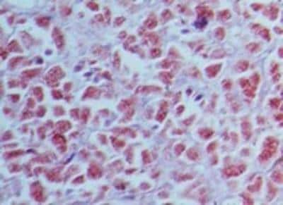 Immunohistochemistry-Paraffin: EMAP-II/AIMP1 Antibody [NBP2-27206]