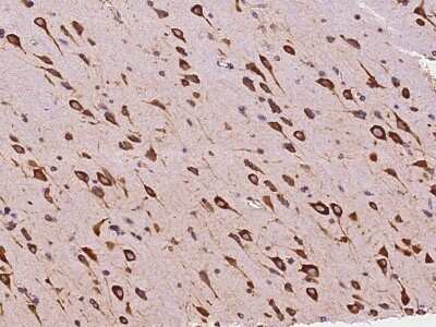 Immunohistochemistry-Paraffin: EMAP-II/AIMP1 Antibody [NBP2-99128]