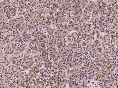 Immunohistochemistry-Paraffin: EMAP-II/AIMP1 Antibody [NBP2-99128]
