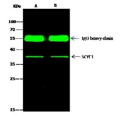 Immunoprecipitation: EMAP-II/AIMP1 Antibody [NBP2-98343]