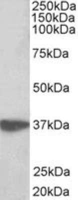 Western Blot: EMAP-II/AIMP1 Antibody [NBP2-26124]