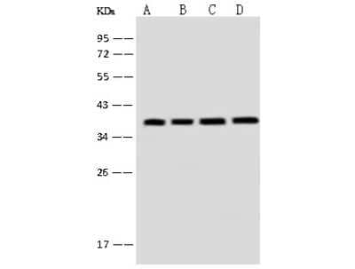 Western Blot: EMAP-II/AIMP1 Antibody [NBP2-99128]